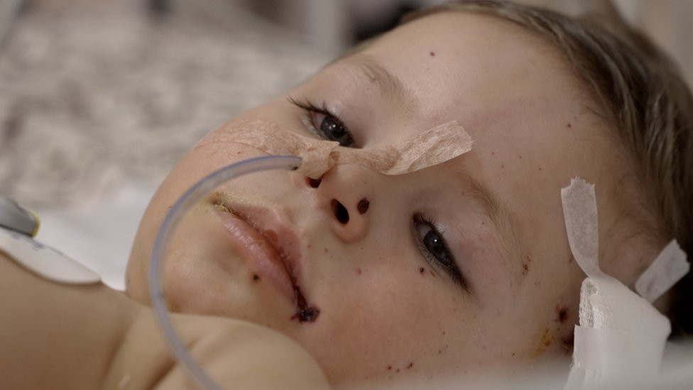 Artem lies in his hospital bed