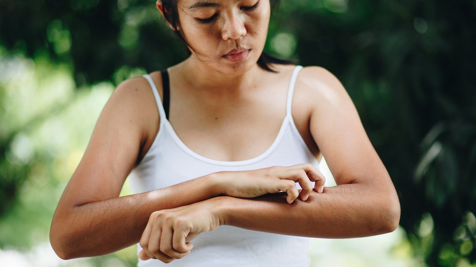 Woman scratching her arm