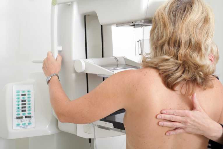 mamografski pregled /ilustracija Pixabay
