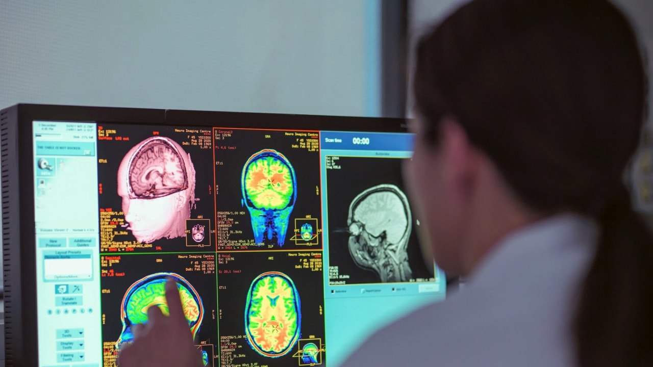 Brain scan