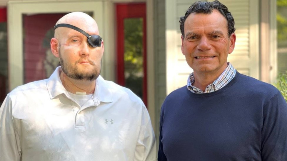 Aron Džejms, iz Arkanzasa, zajedno sa doktorom Edvardom D. Rodrigezom pošto je prošao kroz prvu transplantaciju celog oka u svetu