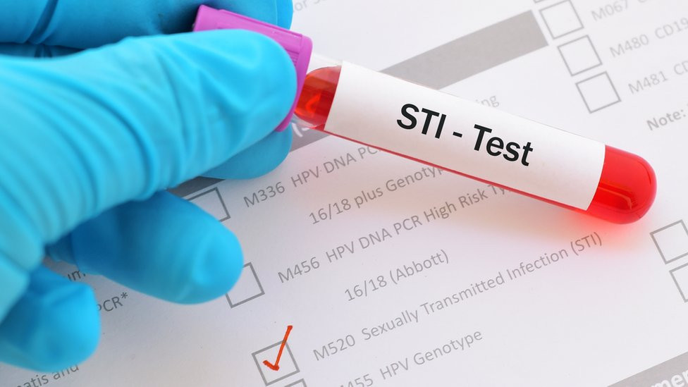 STI test tube