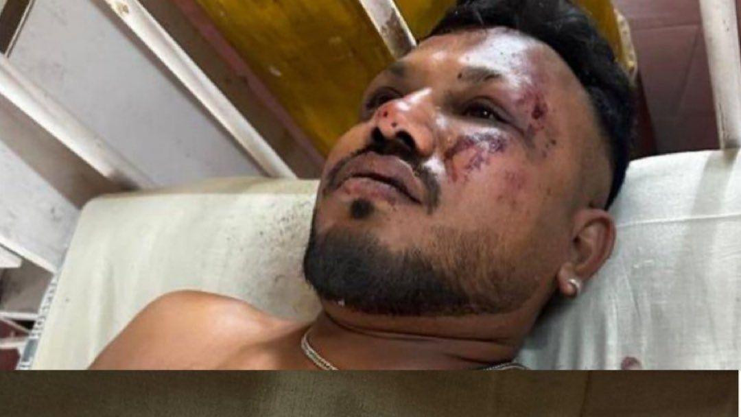 Višvaškumar Rameš, jedini preživeli iz aviona Er Indija koji se srušio na grad Ahmedabad odmah po poletanju za London