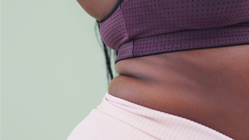 A black woman with fat folds