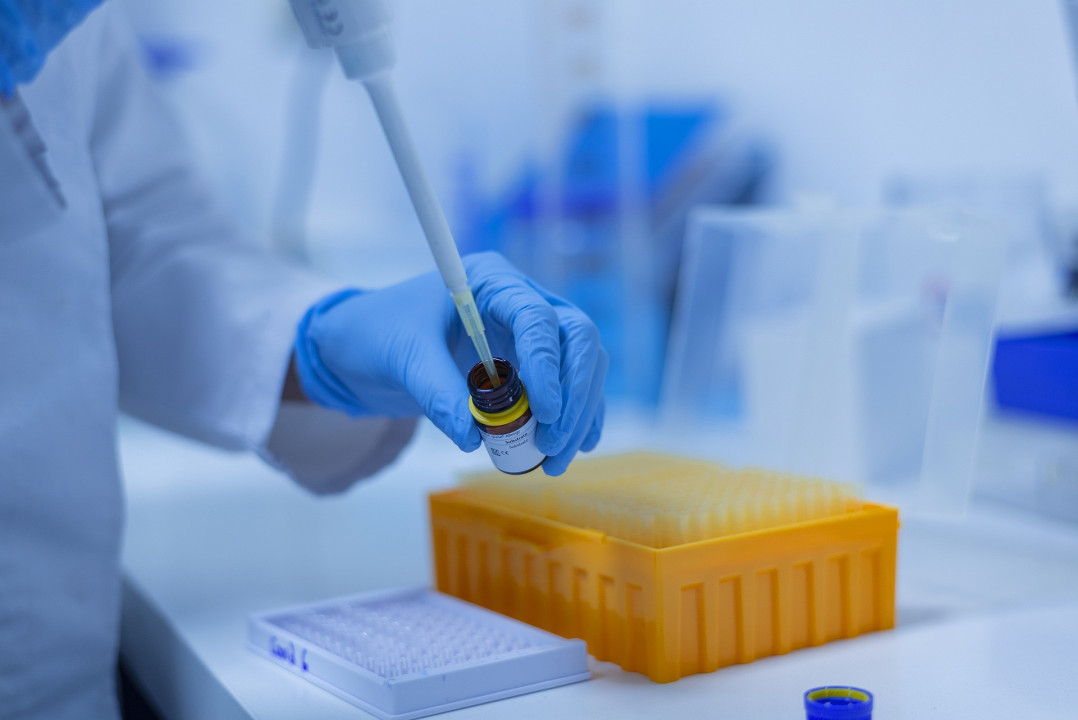 Laboratorija test covid/ Foto / Pixabay